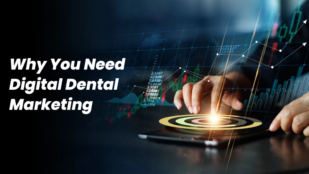 Why You Need Digital Dental Marketing